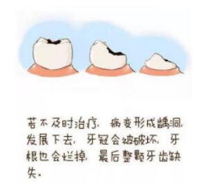 21点技巧